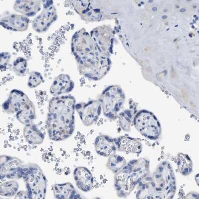 Immunohistochemistry-Paraffin: DNAI1 Antibody [NBP1-84466]