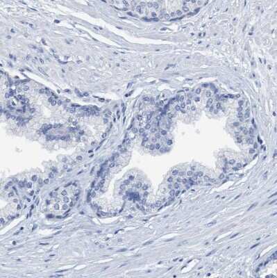 Immunohistochemistry-Paraffin: DNAI1 Antibody [NBP1-84466]