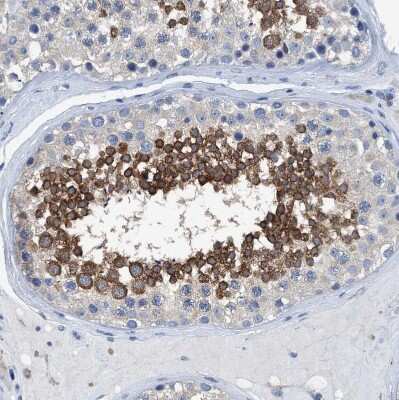 Immunohistochemistry-Paraffin: DNAI1 Antibody [NBP1-84466]