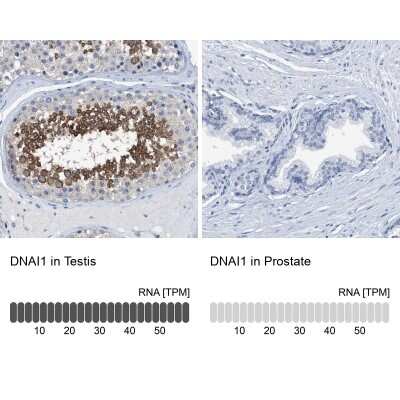 Immunohistochemistry-Paraffin: DNAI1 Antibody [NBP1-84466]