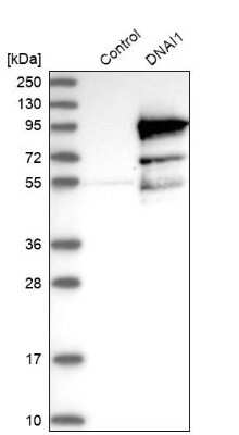 Western Blot: DNAI1 Antibody [NBP1-84465]