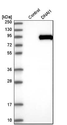 Western Blot: DNAI1 Antibody [NBP1-84466]