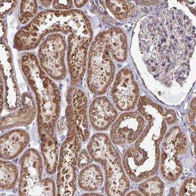 Immunohistochemistry-Paraffin: DNAJA2 Antibody [NBP2-32551]