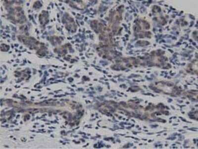 Immunohistochemistry: DNAJA2 Antibody (OTI3A10) - Azide and BSA Free [NBP2-71565]