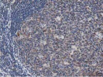 Immunohistochemistry: DNAJA2 Antibody (OTI3A10) - Azide and BSA Free [NBP2-71565]