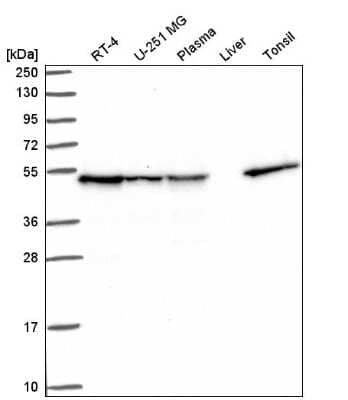 Western Blot: DNAJA2 Antibody [NBP2-57134]