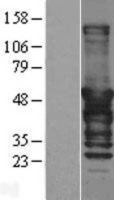 Western Blot: DNAJA2 Overexpression Lysate [NBL1-09930]