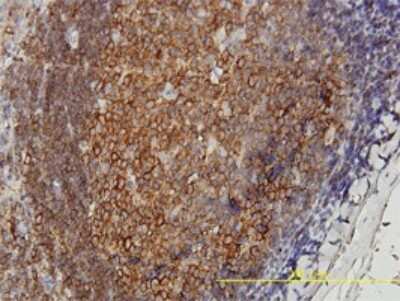Immunohistochemistry-Paraffin: DNAJA4 Antibody (4B4-1F2) [H00055466-M01]
