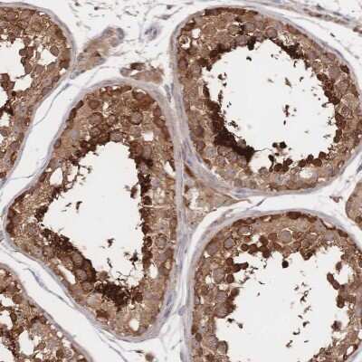 Immunohistochemistry-Paraffin: DNAJA4 Antibody [NBP2-58975]