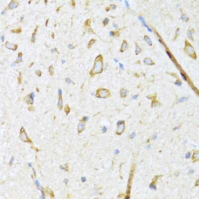 Immunohistochemistry-Paraffin: DNAJB11 Antibody - Azide and BSA Free [NBP2-92708]