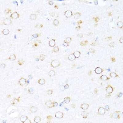 Immunohistochemistry-Paraffin: DNAJB11 Antibody - Azide and BSA Free [NBP2-92708]