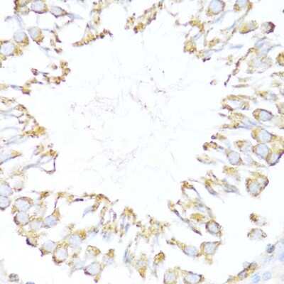 Immunohistochemistry-Paraffin: DNAJB11 Antibody - Azide and BSA Free [NBP2-92708]
