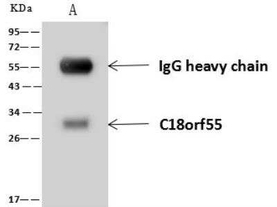 Immunoprecipitation: DNAJB11 Antibody [NBP3-12545]