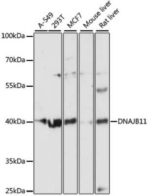 Western Blot: DNAJB11 AntibodyAzide and BSA Free [NBP2-92708]