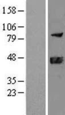 Western Blot: DNAJB11 Overexpression Lysate [NBL1-09933]