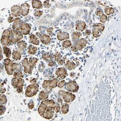 Immunohistochemistry-Paraffin: DNAJB12 Antibody [NBP1-85208]
