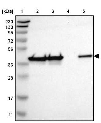 Western Blot: DNAJB12 Antibody [NBP1-85208]