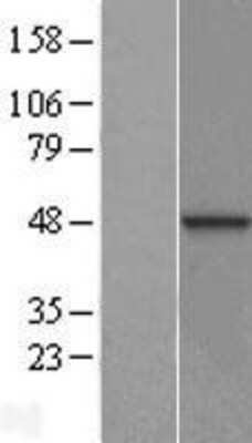 Western Blot: DNAJB12 Overexpression Lysate [NBL1-09934]