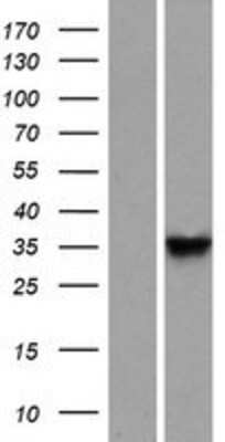 Western Blot: DNAJB13 Overexpression Lysate [NBP2-05233]