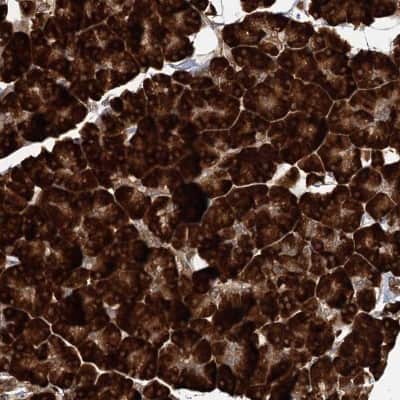 Immunohistochemistry-Paraffin: DNAJB14 Antibody [NBP1-82240]