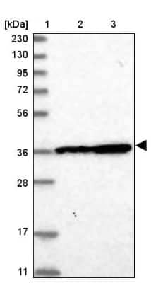 Western Blot: DNAJB14 Antibody [NBP1-82240]