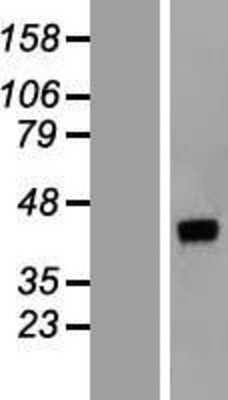 Western Blot: DNAJB14 Overexpression Lysate [NBL1-09935]