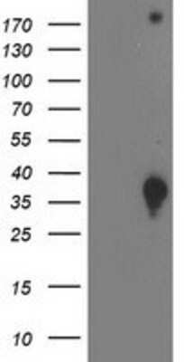 Western Blot: DNAJB2 Antibody (OTI4D12) [NBP2-00638]