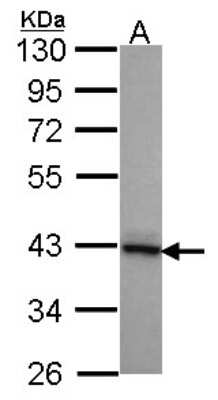 Western Blot: DNAJB2 Antibody [NBP1-32249]