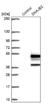 Western Blot: DNAJB2 Antibody [NBP1-83188]