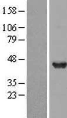 Western Blot: DNAJB2 Overexpression Lysate [NBL1-09936]