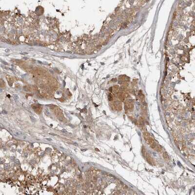 Immunohistochemistry-Paraffin: DNAJB4 Antibody [NBP1-81735]