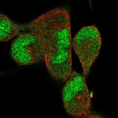 Immunocytochemistry/ Immunofluorescence: DNAJB5 Antibody [NBP2-58535]