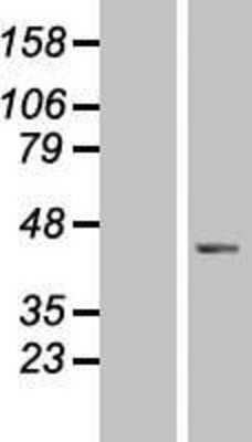 Western Blot: DNAJB5 Overexpression Lysate [NBP2-07468]