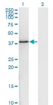 Western Blot: DNAJB6 Antibody (1A5) [H00010049-M03]