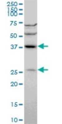 Western Blot: DNAJB6 Antibody (2C11-C1) [H00010049-M01]