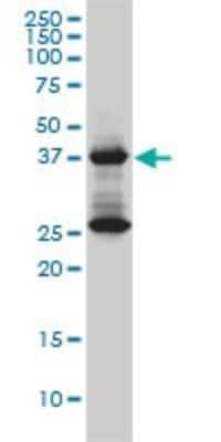 Western Blot: DNAJB6 Antibody (2C11-C1) [H00010049-M01]