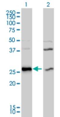 Western Blot: DNAJB6 Antibody (2C11-C1) [H00010049-M01]