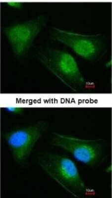 Immunocytochemistry/ Immunofluorescence: DNAJB6 Antibody [NBP1-32175]