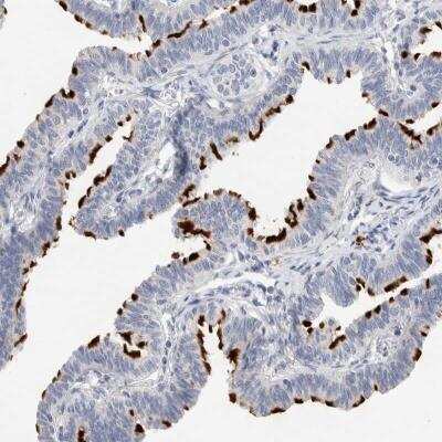 Immunohistochemistry: DNAJB6 Antibody [NBP1-82624]