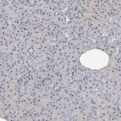 Immunohistochemistry-Paraffin: DNAJB6 Antibody [NBP1-82624]
