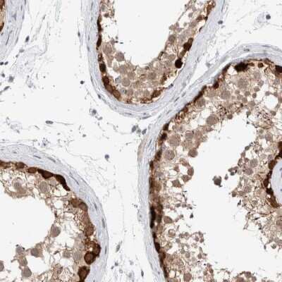 Immunohistochemistry-Paraffin: DNAJB6 Antibody [NBP1-82624]