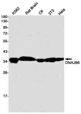 Western Blot: DNAJB6 Antibody (S01-8K2) [NBP3-15024]