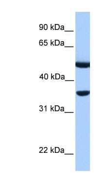 Western Blot: DNAJB6 Antibody [NBP1-54951]