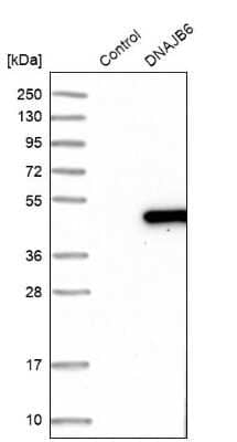 Western Blot: DNAJB6 Antibody [NBP1-82624]