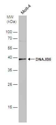 Western Blot: DNAJB6 Antibody [NBP2-16193]