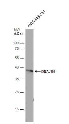 Western Blot: DNAJB6 Antibody [NBP2-16193]