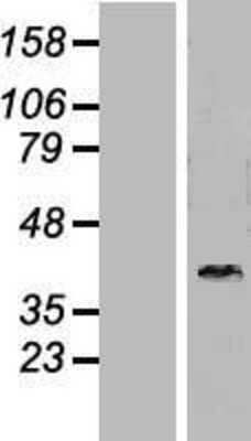 Western Blot: DNAJB6 Overexpression Lysate [NBL1-09940]