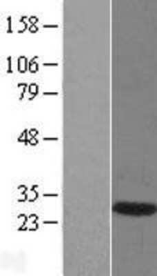 Western Blot: DNAJB6 Overexpression Lysate [NBL1-09941]