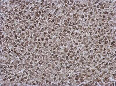 Immunohistochemistry-Paraffin: DNAJB7 Antibody [NBP2-16194]