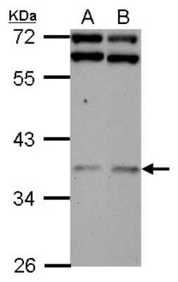 Western Blot: DNAJB7 Antibody [NBP2-16194]